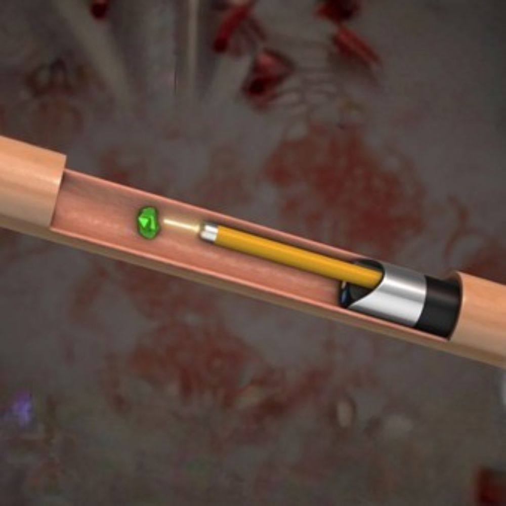 URSL procedure image 1