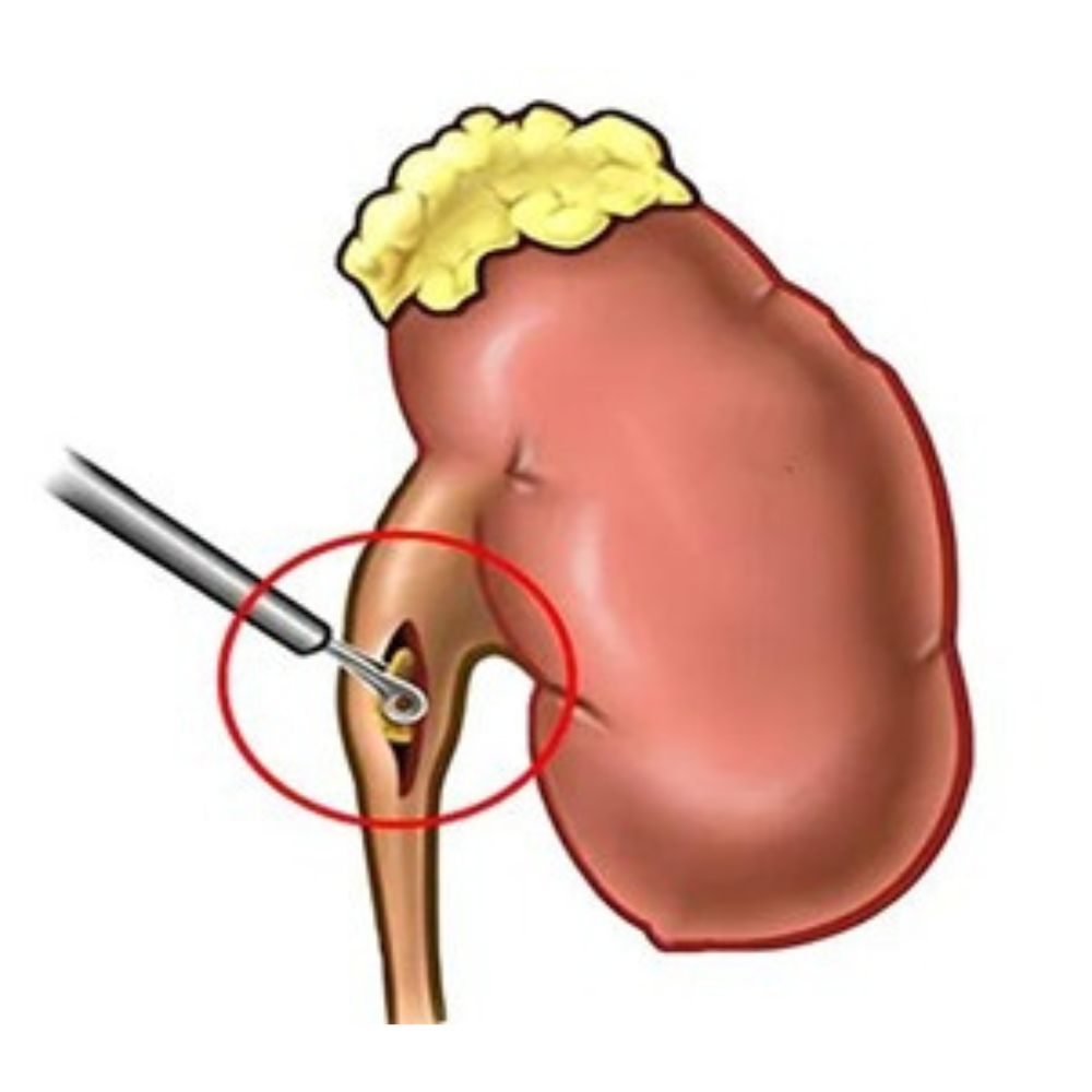 Kidney anatomy illustration