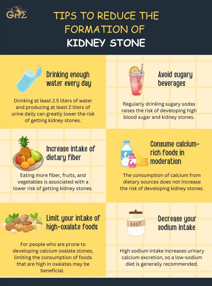 Tips to Reduce the Formation of Kidney Stone
