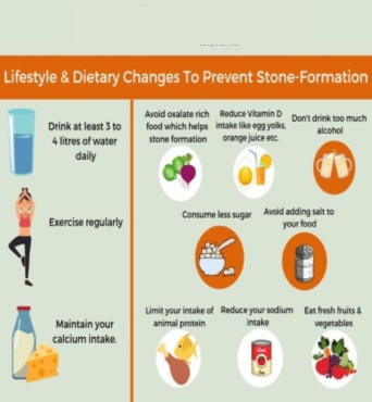 Lifestyle & Dietary Changes To Prevent Stone-Formation