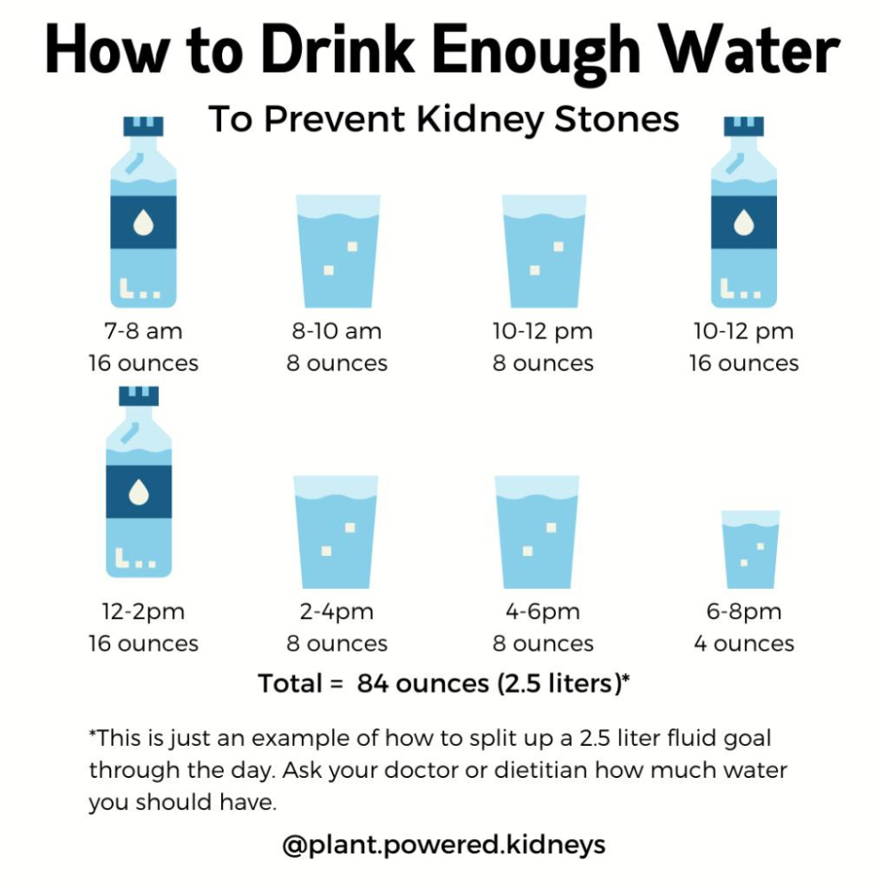 How to Drink Enough Water to Prevent Kidney Stones
